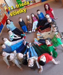 Svetový deň Downovho syndrómu